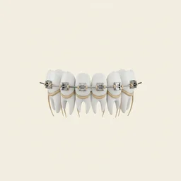 Aparat dentar